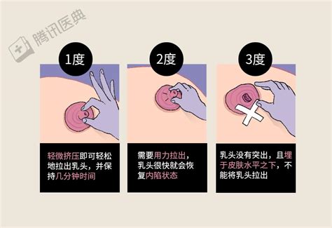 胸部長一根毛|乳头边上有毛毛正常吗？10 个你需要知道的小问题